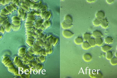 blood-before-and-after - Arushiom Foundation Blood sample from a stage 4 cancer patient before and after an emotional release session.